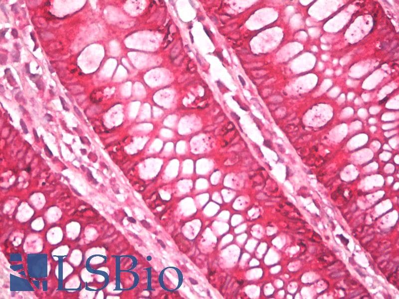 IHC-plus™ Monoclonal Mouse anti-Human AGR2/AGR3 Antibody (clone AGR3.4, IHC, WB)