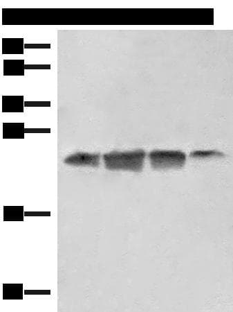 Polyclonal Rabbit anti-Human EIF3K Antibody (IHC, WB)