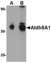 IHC-plus™ ALDH5A1 Antibody