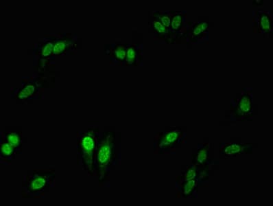 Polyclonal Rabbit anti-Human NCF2 / NOXA2 / p67phox Antibody (IHC, IF, WB)