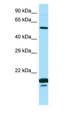 SPINT1 / HAI-1 Antibody (aa168-217)