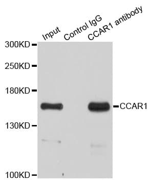 DIS / CCAR1 Antibody