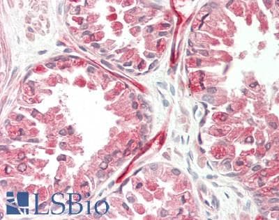 Polyclonal Rabbit anti-Human MAP4 Antibody (N-Terminus, IHC, WB)