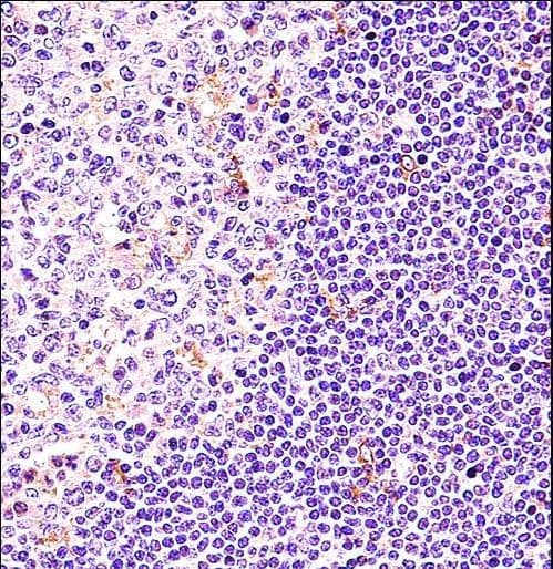 BTK Antibody (aa27-55)