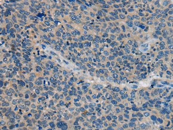 BACE2 Antibody