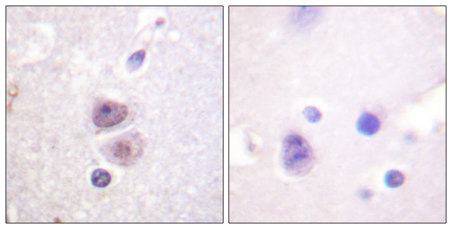 MAPK14 / p38 Antibody (aa288-337)