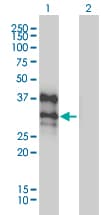 BP1 / DLX4 Antibody (clone 1F11)