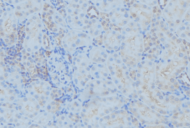 DYNC1H1 Antibody