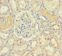 Polyclonal Rabbit anti-Human IDO2 / INDOL1 Antibody (aa1-407, WB)