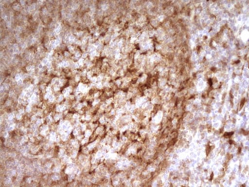 IHC-plus™ LGALS9 / Galectin 9 Antibody (clone 2A4)