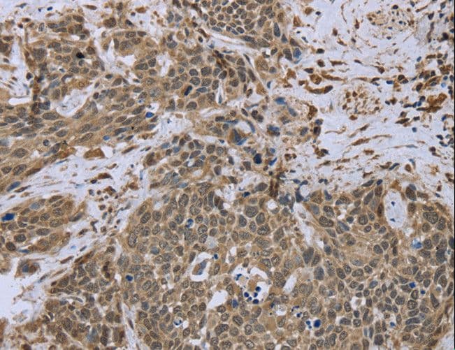 Polyclonal Rabbit anti-Human DCTN4 / Dynactin 4 Antibody (IHC)