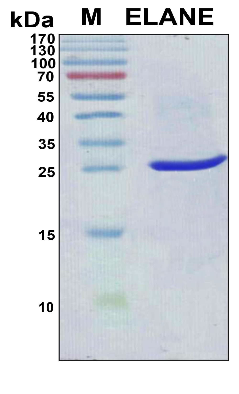 Human HNE / Neutrophil Elastase Protein (Recombinant 6His, N-terminus)