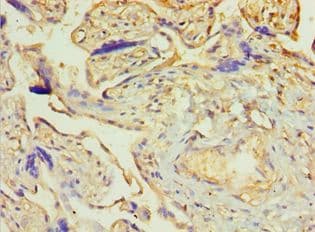 PDLIM1 Antibody (aa1-329)