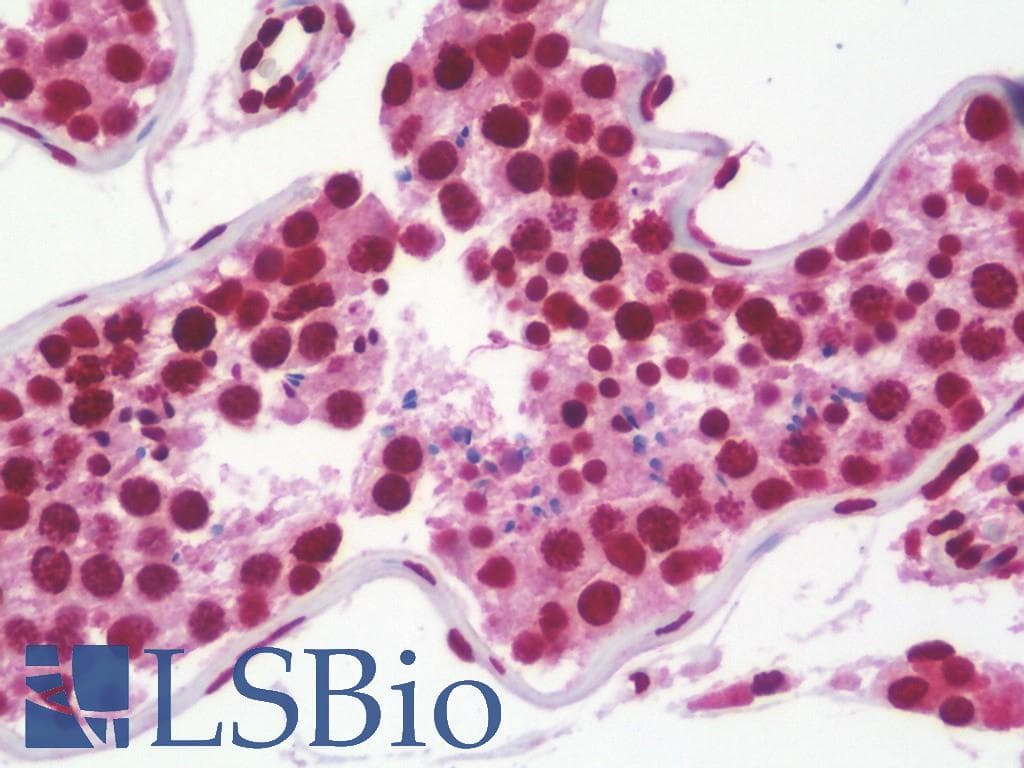 IHC-plus™ Polyclonal Rabbit anti-Human ETV6 / TEL Antibody (aa84-111, IHC, WB)
