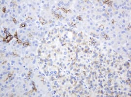 Monoclonal Mouse anti-Human ABCB1 / MDR1 / P Glycoprotein Antibody (clone OTI2C7, IHC, WB)