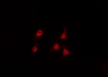Polyclonal Rabbit anti-Human SP1 Antibody (phospho-Thr739, IHC, IF, WB)
