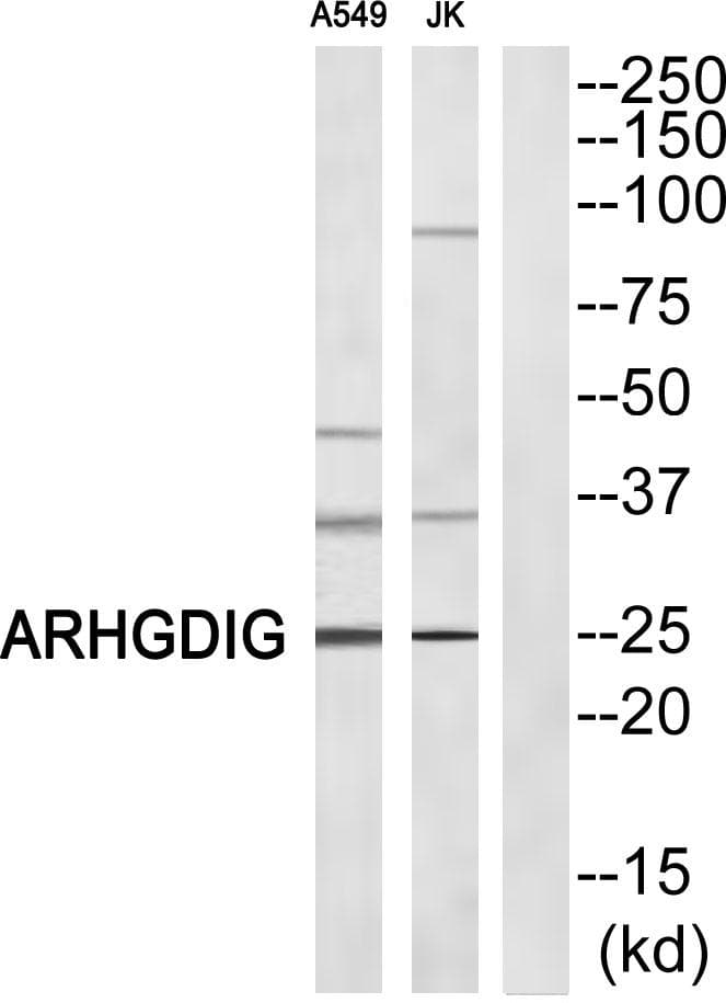 Polyclonal Rabbit anti-Human ARHGDIG / RHOGDI-3 Antibody (WB)