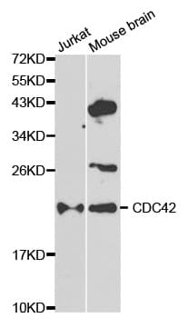 IHC-plus™ Polyclonal Rabbit anti-Human CDC42 Antibody (IHC, WB)