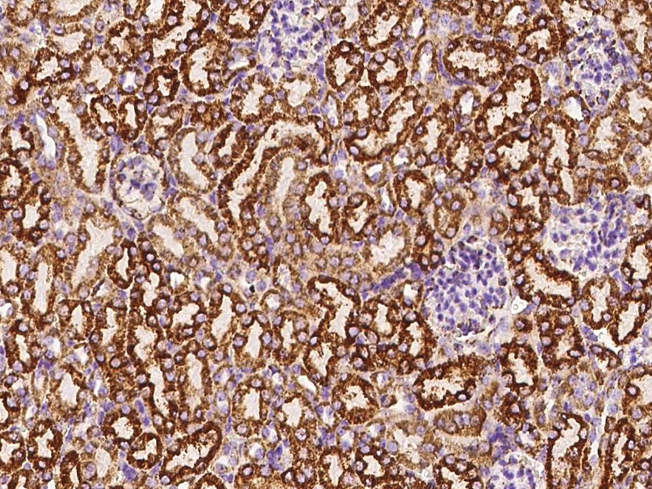 GC1qR / C1QBP Antibody (Preservative Free)