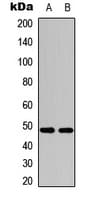 Polyclonal Rabbit anti-Human JUN / c-Jun Antibody (phospho-Ser243, IHC, IF, WB)