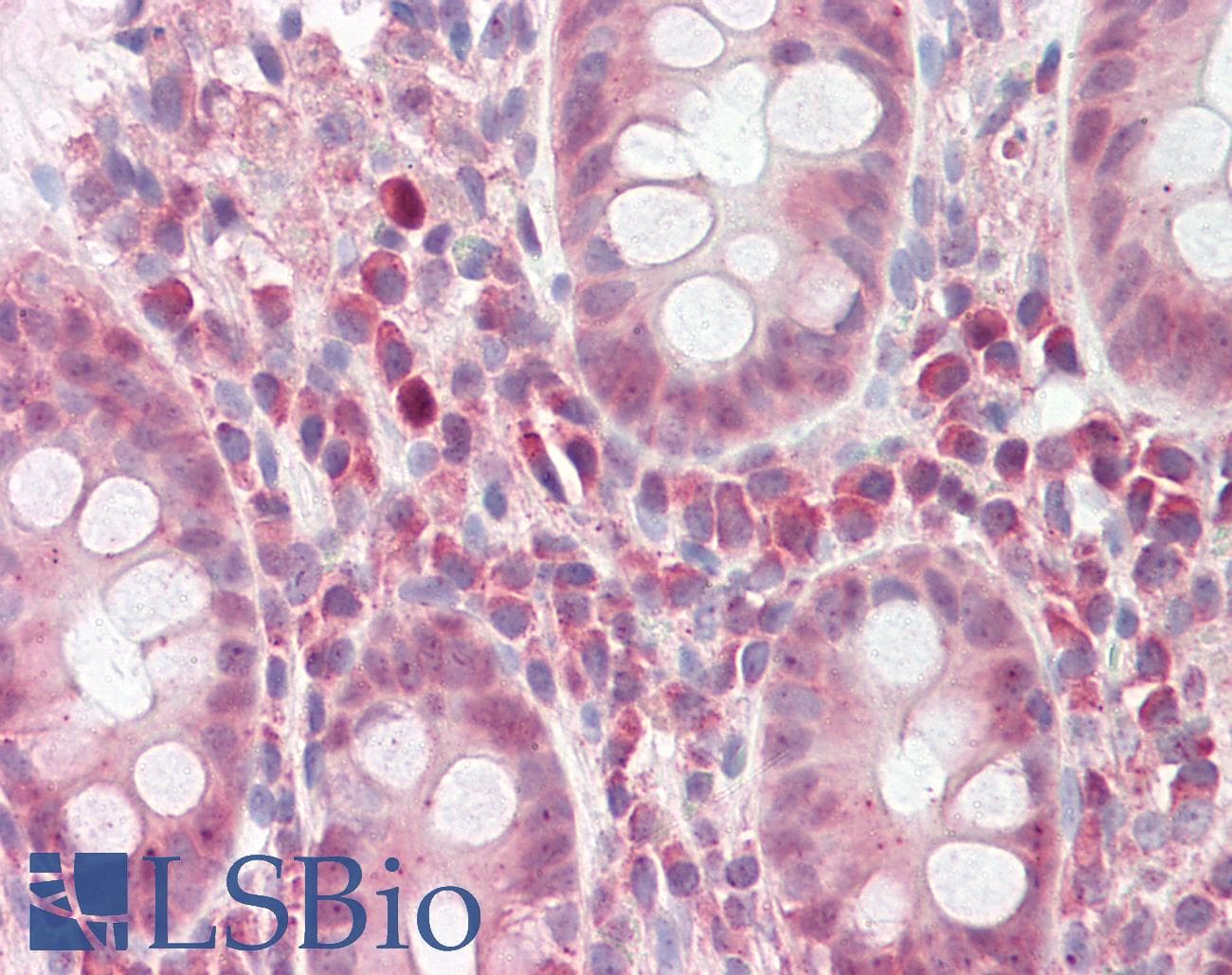 WARS Antibody (aa35-84)