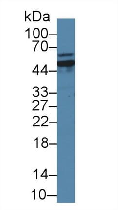 GLS / Glutaminase Antibody (aa31-253)