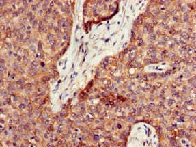 PPT1 / CLN1 Antibody