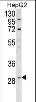 DIO1 / TXDI1 Antibody (aa30-57)