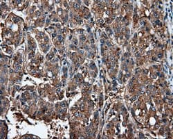 IFIT1 / ISG56 Antibody (clone OTI3G8)