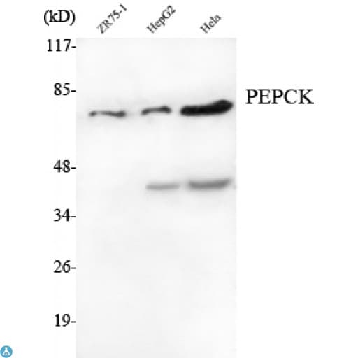 PCK2 / PEPCK Antibody