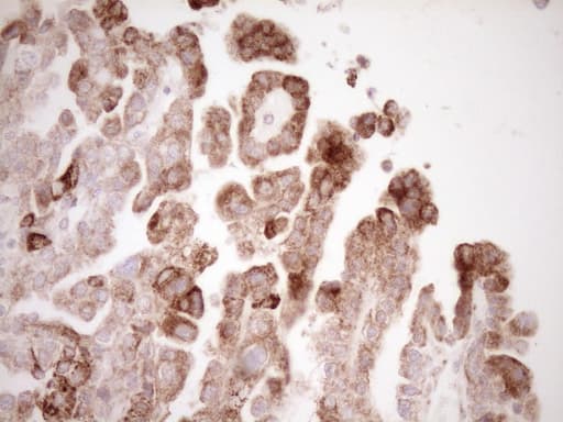 VIP Antibody (clone OTI1E8)