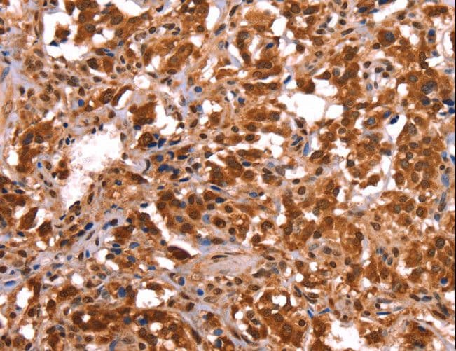 Polyclonal Rabbit anti-Human ESRRB / ERR Beta Antibody (IHC)