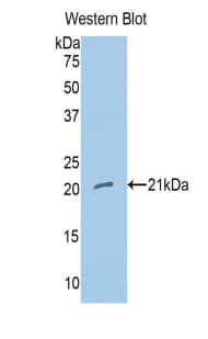 NOS1 / nNOS Antibody (aa726-894, Biotin)