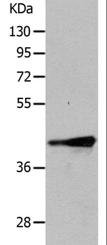 Polyclonal Rabbit anti-Human MURF1 / IRF Antibody (IHC, WB)