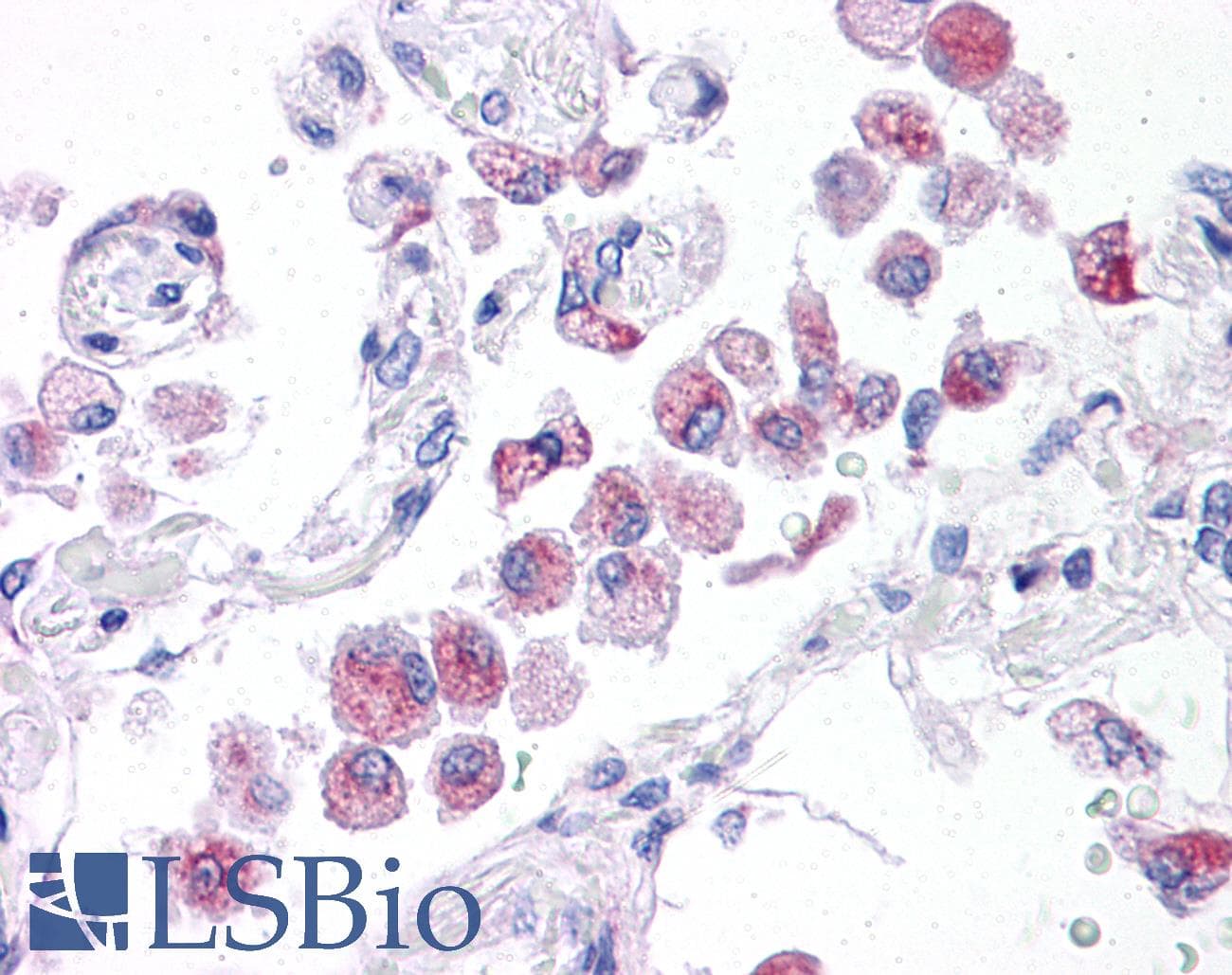 IHC-plus™ Polyclonal Rabbit anti-Human NLRP14 / NALP14 Antibody (IHC, WB)