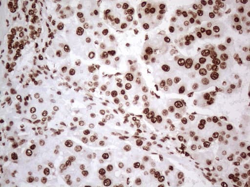 Monoclonal Mouse anti-Human HNRNPL / hnRNP L Antibody (clone OTI4E5, aa270-502, IHC)