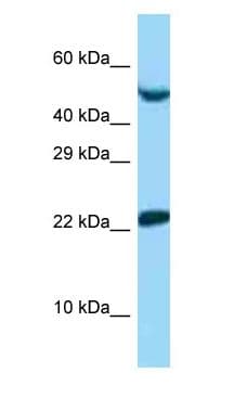 UBE2E1 / UBCH6 Antibody (aa25-74)