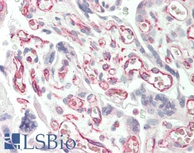 SLC38A3 / SNAT3 Antibody (aa31-80)