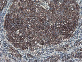 SENP2 Antibody (aa139-523, clone OTI1B8)