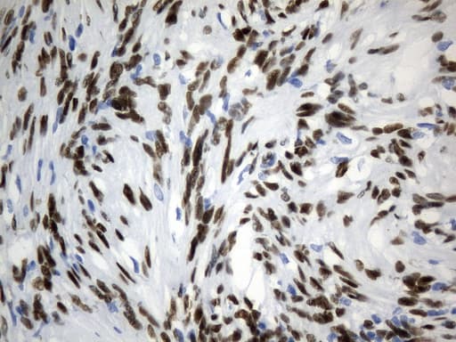 Monoclonal Mouse anti-Human TLE1 / TLE 1 Antibody (clone UMAB253, aa180-460, IHC, IF, WB)
