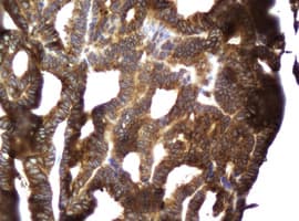 CCDC93 Antibody (aa293-631, clone OTI6E11, Carrier-free)