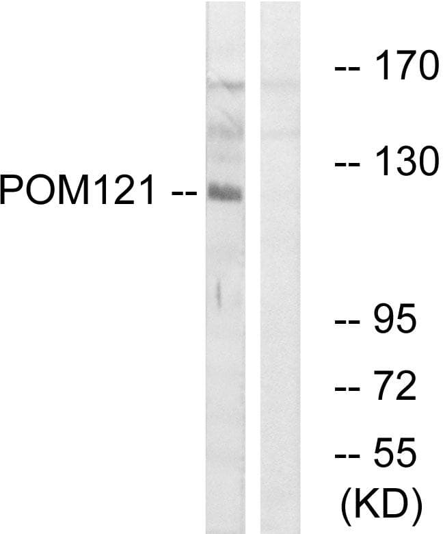 POM121 Antibody