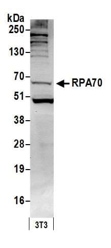Polyclonal Rabbit anti-Human RPA70 / RPA1 Antibody (aa350-400, IHC, WB)