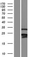 Human RNF138 Protein (Over-Expression Lysate Myc-DDK (Flag))