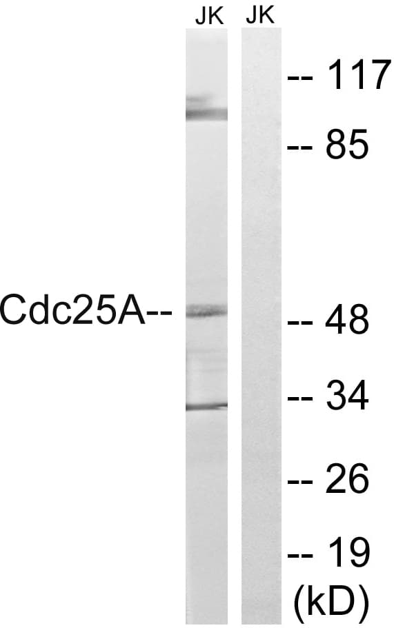 CDC25A Antibody (aa144-193)