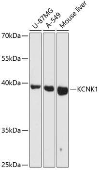 TWIK1 / KCNK1 Antibody