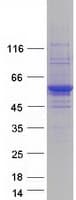 Human Tyrosine Aminotransferase Protein (Recombinant Myc-DDK (Flag))