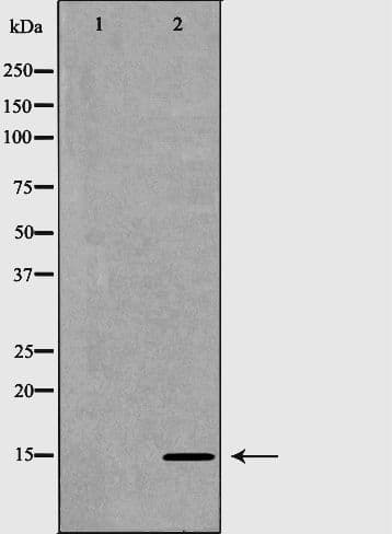 Polyclonal Rabbit anti-Human NDP Antibody (IHC, WB)