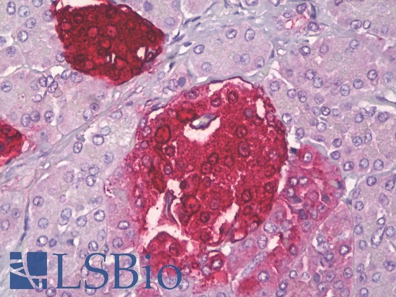 PathPlus™ SST / Somatostatin Antibody (aa10-59)