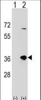 Polyclonal Rabbit anti-Human SULT1B1 / Sulfotransferase 1B1 Antibody (aa191-219, WB)